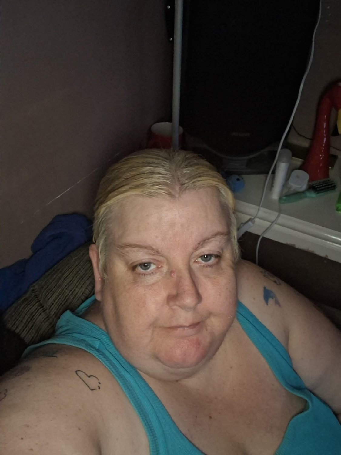 Fatty exposed #zG29zij0